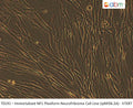 Immortalized NF1 Plexiform Neurofibroma Cell Line (ipNF06.2A) - hTERT | Applied Biological Materials (abm)