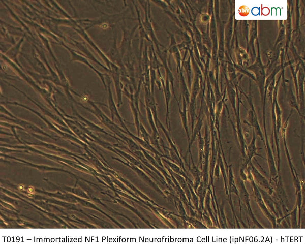 Immortalized NF1 Plexiform Neurofibroma Cell Line (ipNF06.2A) - hTERT | Applied Biological Materials (abm)