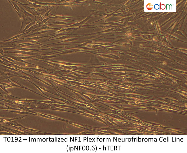 Immortalized NF1 Plexiform Neurofibroma Cell Line (ipNF00.6) - hTERT | Applied Biological Materials (abm)