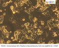 Immortalized NF1 Plexiform Neurofibroma Cell Line (ipNF03.3) - hTERT | Applied Biological Materials (abm)