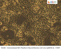 Immortalized NF1 Plexiform Neurofibroma Cell Line (ipNF04.4) - hTERT | Applied Biological Materials (abm)