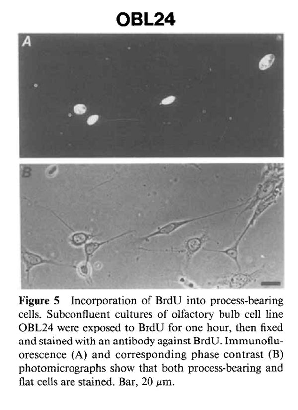 Immortalized Mouse Olfactory Bulb Cells (OBL24) | Applied Biological Materials (abm)