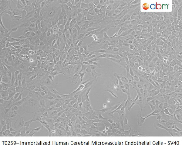Immortalized Human Cerebral Microvascular Endothelial Cells - SV40 | Applied Biological Materials (abm)