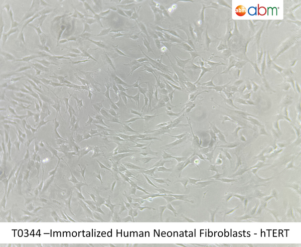 Immortalized Human Neonatal Fibroblasts - hTERT | Applied Biological Materials (abm)