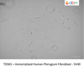 Immortalized Human Pterygium Fibroblast - SV40 | Applied Biological Materials (abm)