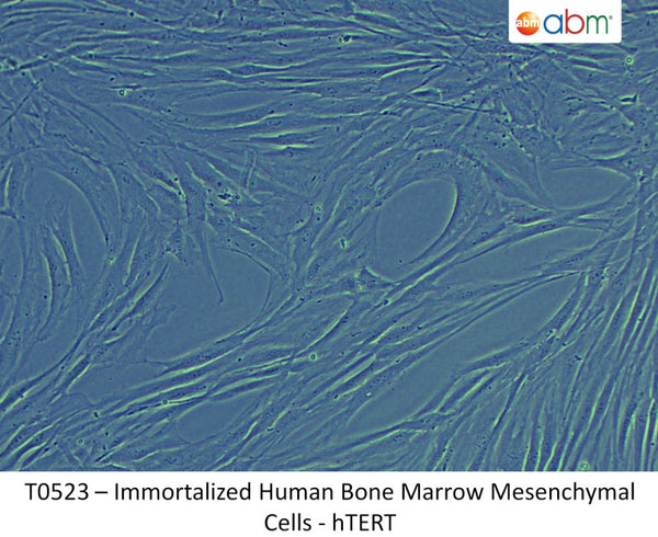 Immortalized Human Bone Marrow Mesenchymal Cells - hTERT | Applied Biological Materials (abm)