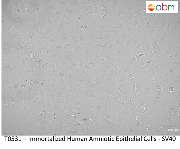 Immortalized Human Amniotic Epithelial Cells - SV40 | Applied Biological Materials (abm)