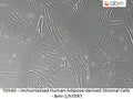 Immortalized Human Adipose-derived Stromal Cells - Bmi-1/hTERT | Applied Biological Materials (abm)