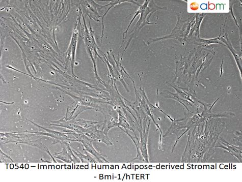 Immortalized Human Adipose-derived Stromal Cells - Bmi-1/hTERT | Applied Biological Materials (abm)