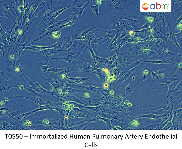 Immortalized Human Pulmonary Artery Endothelial Cells | Applied Biological Materials (abm)