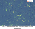 Immortalized Human Pulmonary Artery Smooth Muscle Cells | Applied Biological Materials (abm)