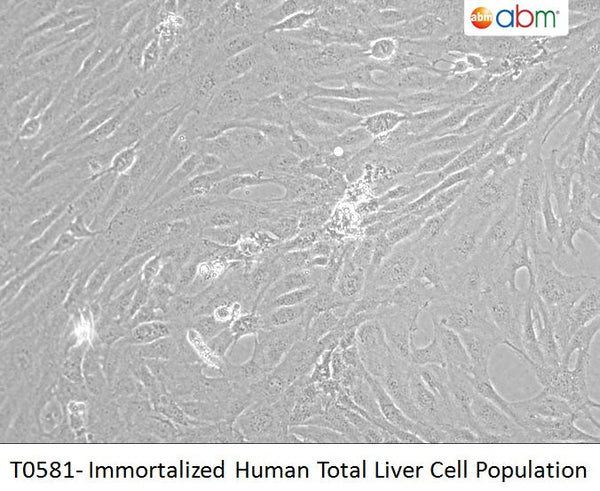 Immortalized Human Total Liver Cell Population | Applied Biological Materials (abm)