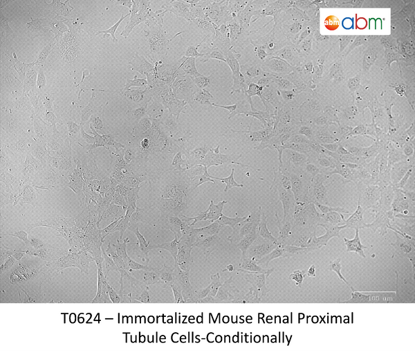 Immortalized Mouse Renal Proximal Tubule Cells - Conditionally | Applied Biological Materials (abm)