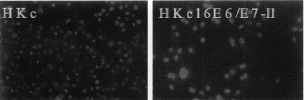 Immortalized Human Neonatal Foreskin Keratinocytes (HKc16E6/E7-II) | Applied Biological Materials (abm)