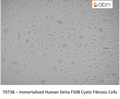 Immortalized Human Delta F508 Cystic Fibrosis Cells – Figure 1 of 1