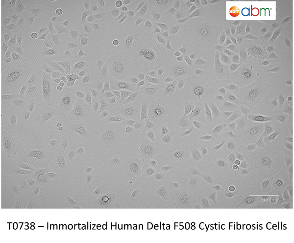 Immortalized Human Delta F508 Cystic Fibrosis Cells – Figure 1 of 1