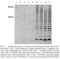 Immortalized Human Telomerized Endometrial Stromal Cells (SHT290) | Applied Biological Materials (abm)