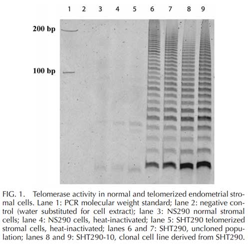 Immortalized Human Telomerized Endometrial Stromal Cells (SHT290) | Applied Biological Materials (abm)