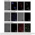Immortalized Mouse p19ARF null Hepatic Stellate Cells (M1-4 HSC) | Applied Biological Materials (abm)