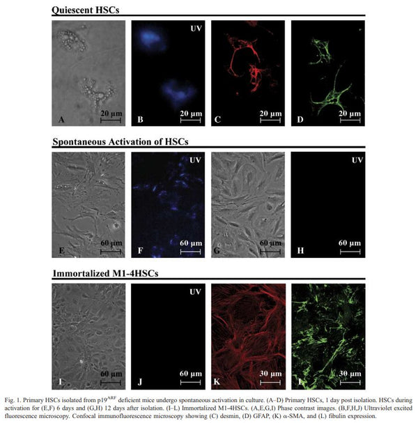 Immortalized Mouse p19ARF null Hepatic Stellate Cells (M1-4 HSC) | Applied Biological Materials (abm)