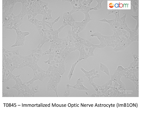 Immortalized Mouse Optic Nerve Astrocyte (ImB1ON) | Applied Biological Materials (abm)