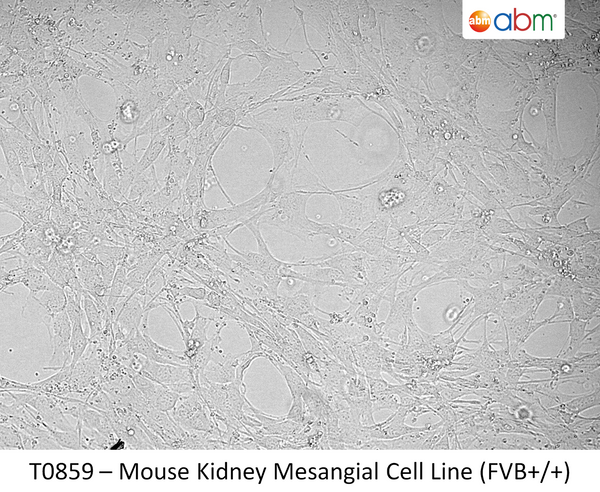 Mouse Kidney Mesangial Cell Line (FVB+/+) | Applied Biological Materials (abm)