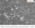 Immortalized Human Lung Fibroblast - hTERT | Applied Biological Materials (abm)
