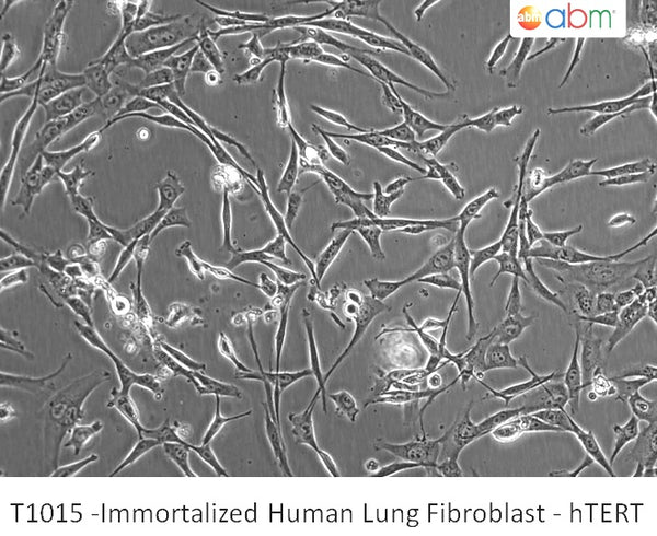 Immortalized Human Lung Fibroblast - hTERT | Applied Biological Materials (abm)