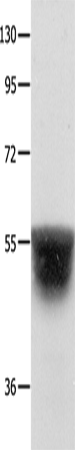 KCNA1 Polyclonal Antibody – Figure 1 of 3