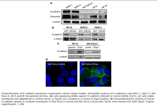 E-cadherin Stable MIA PaCa-2 Cell Line | Applied Biological Materials (abm)
