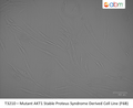 Mutant AKT1 Stable Proteus Syndrome Derived Cell Line (F6B) | Applied Biological Materials (abm)