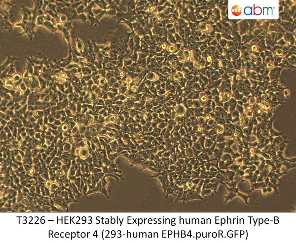 HEK293 Stably Expressing human Ephrin Type-B Receptor 4 (293-human EPHB4.puroR.GFP) | Applied Biological Materials (abm)