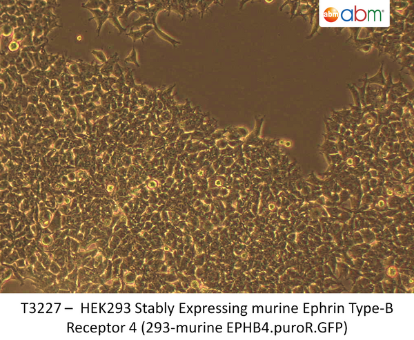 HEK293 Stably Expressing murine Ephrin Type-B Receptor 4 (293-murine EPHB4.puroR.GFP) | Applied Biological Materials (abm)