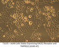 A549 Cells Stably Expressing hACE2 Receptor and TMPRSS2 (A549-AT) | Applied Biological Materials (abm)