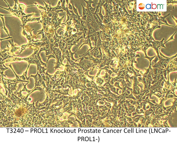 PROL1 Knockout Prostate Cancer Cell Line (LNCaP-PROL1-) | Applied Biological Materials (abm)
