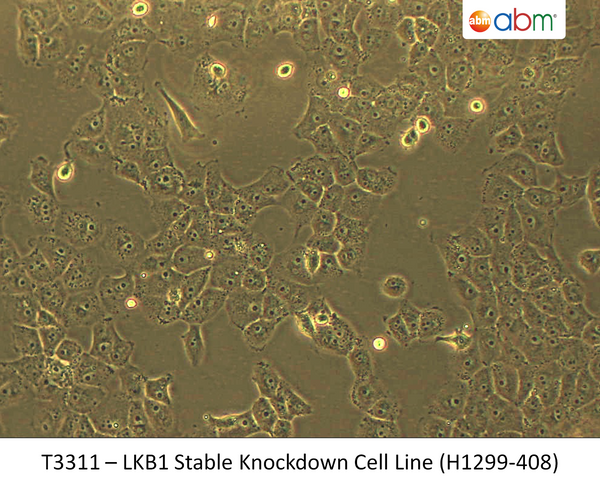 LKB1 Stable Knockdown Cell Line (H1299-408) | Applied Biological Materials (abm)