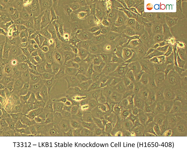 LKB1 Stable Knockdown Cell Line (H1650-408) | Applied Biological Materials (abm)