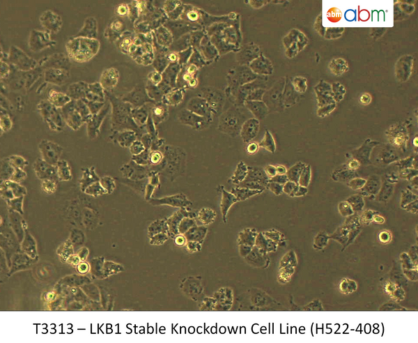 LKB1 Stable Knockdown Cell Line (H522-408) | Applied Biological Materials (abm)