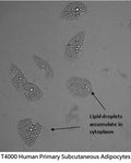 Human Primary Subcutaneous Adipocytes | Applied Biological Materials (abm)