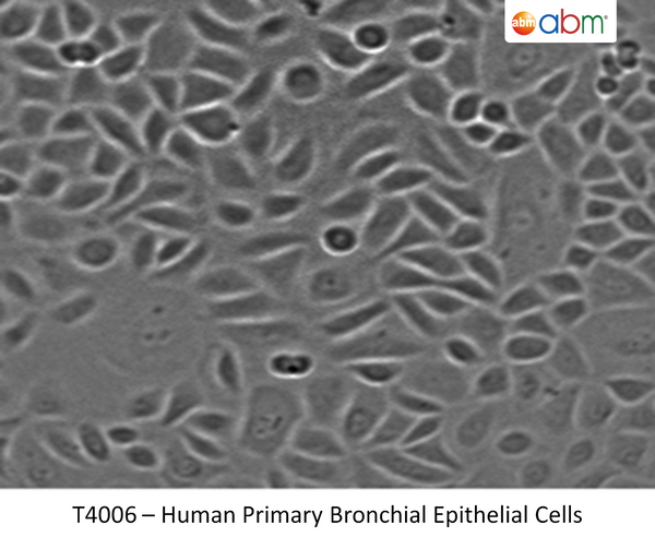 Human Primary Bronchial Epithelial Cells | Applied Biological Materials (abm)
