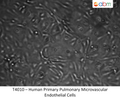 Human Primary Pulmonary Microvascular Endothelial Cells | Applied Biological Materials (abm)