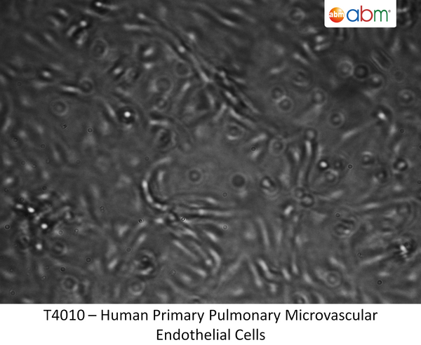 Human Primary Pulmonary Microvascular Endothelial Cells | Applied Biological Materials (abm)