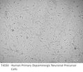 Human Primary Dopaminergic Neuronal Precursor Cells | Applied Biological Materials (abm)