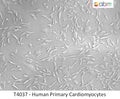 Human Primary Cardiomyocytes | Applied Biological Materials (abm)