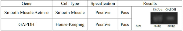 Human Primary Coronary Artery Smooth Muscle Cells | Applied Biological Materials (abm)