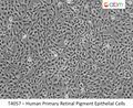 Human Primary Retinal Pigment Epithelial Cells | Applied Biological Materials (abm)