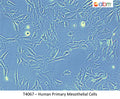 Human Primary Mesothelial Cells | Applied Biological Materials (abm)