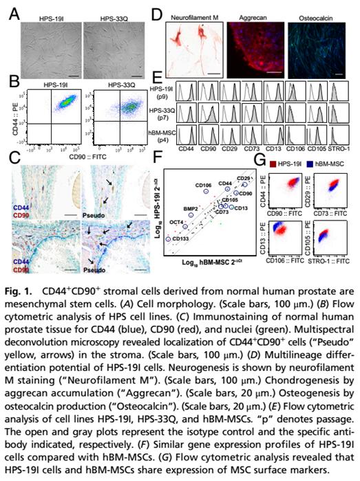 Human Primary Prostate Stromal Mesenchymal Stem Cells (HPS-19I) | Applied Biological Materials (abm)