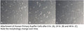 Normal Human Primary Hepatic Kupffer Cells | Applied Biological Materials (abm)