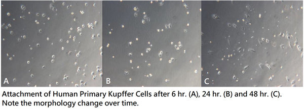 Normal Human Primary Hepatic Kupffer Cells | Applied Biological Materials (abm)